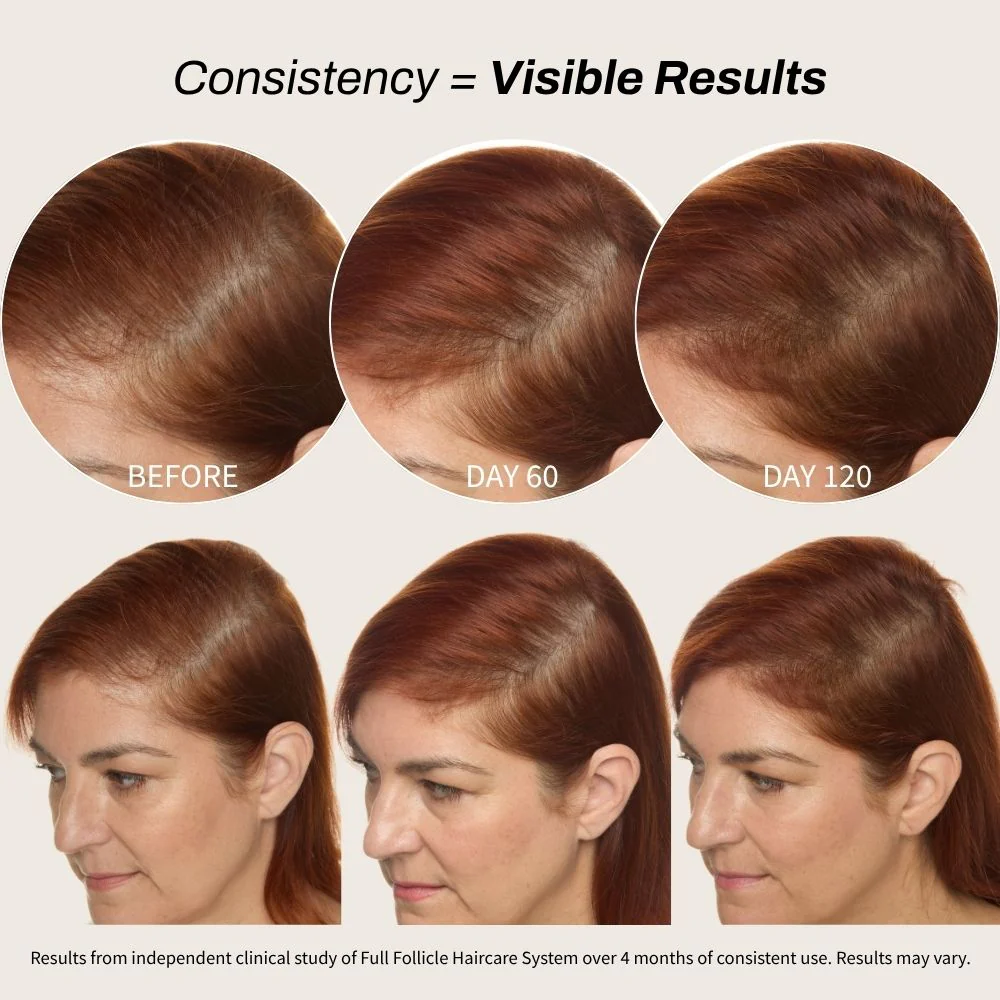 Full Follicle Advanced Scalp Serum - Image 4