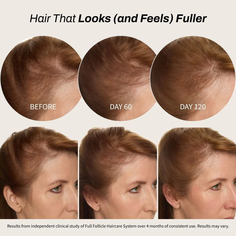 Full Follicle Advanced Scalp Serum - Image 5