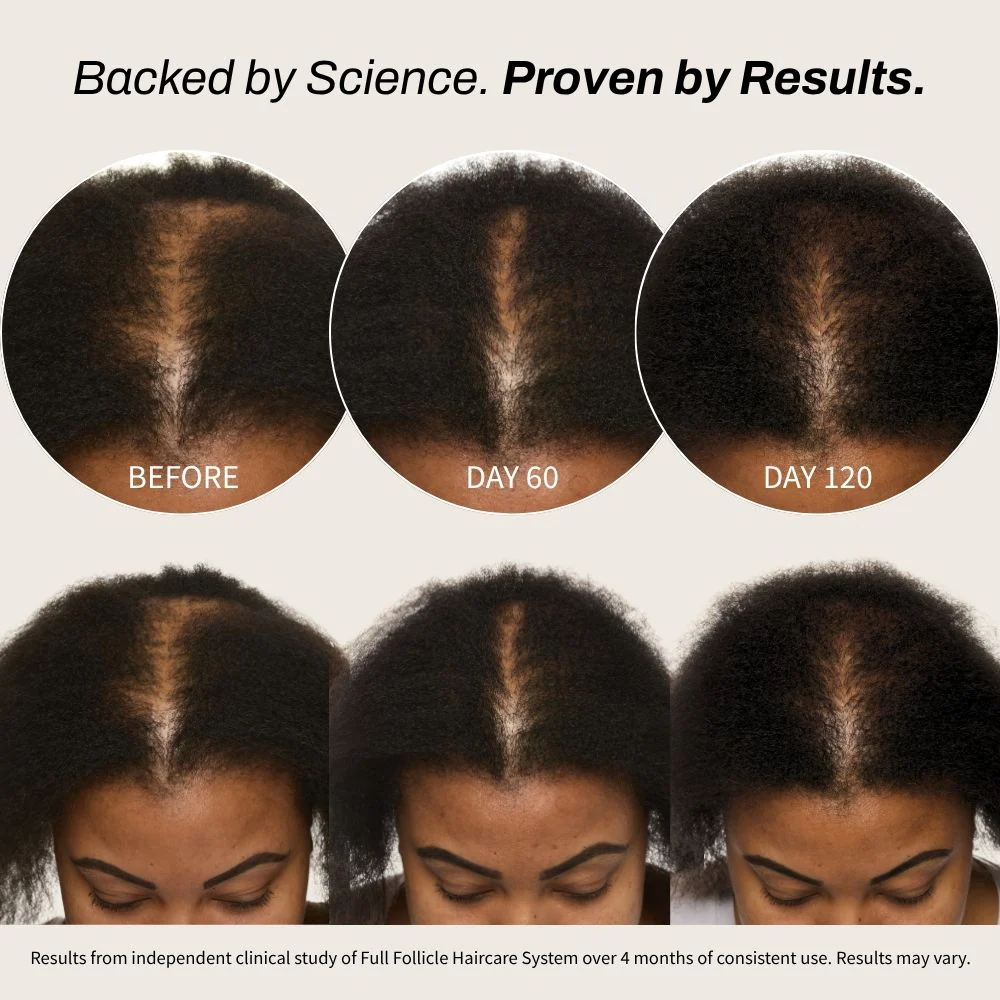 Full Follicle Advanced Scalp Serum - Image 6