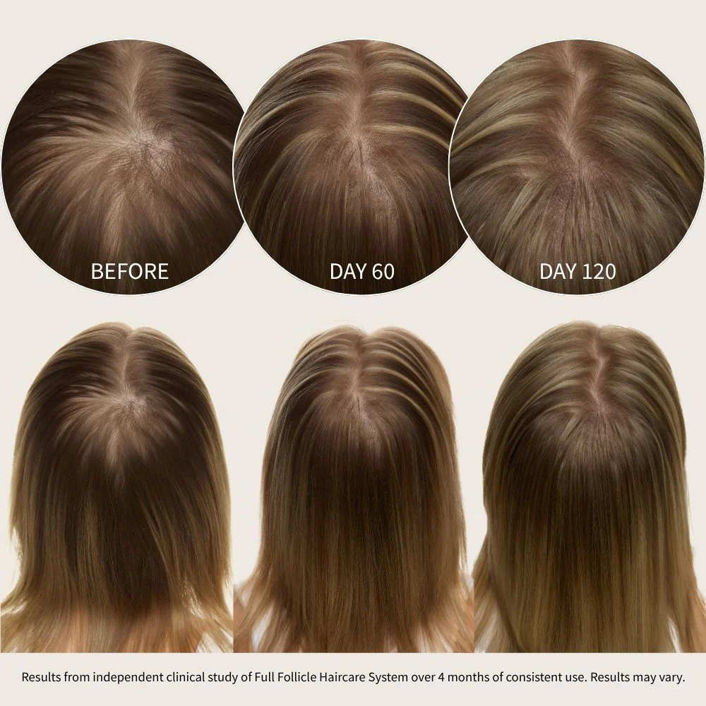 Full Follicle Advanced Scalp Serum - Image 8